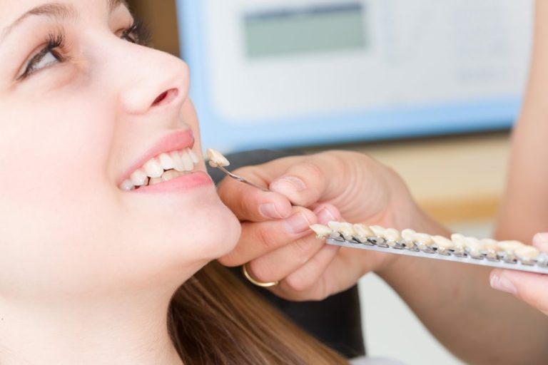 Why You Should Choose David Fisher D.D.S as Cosmetic Dentistry Veneers Specialists